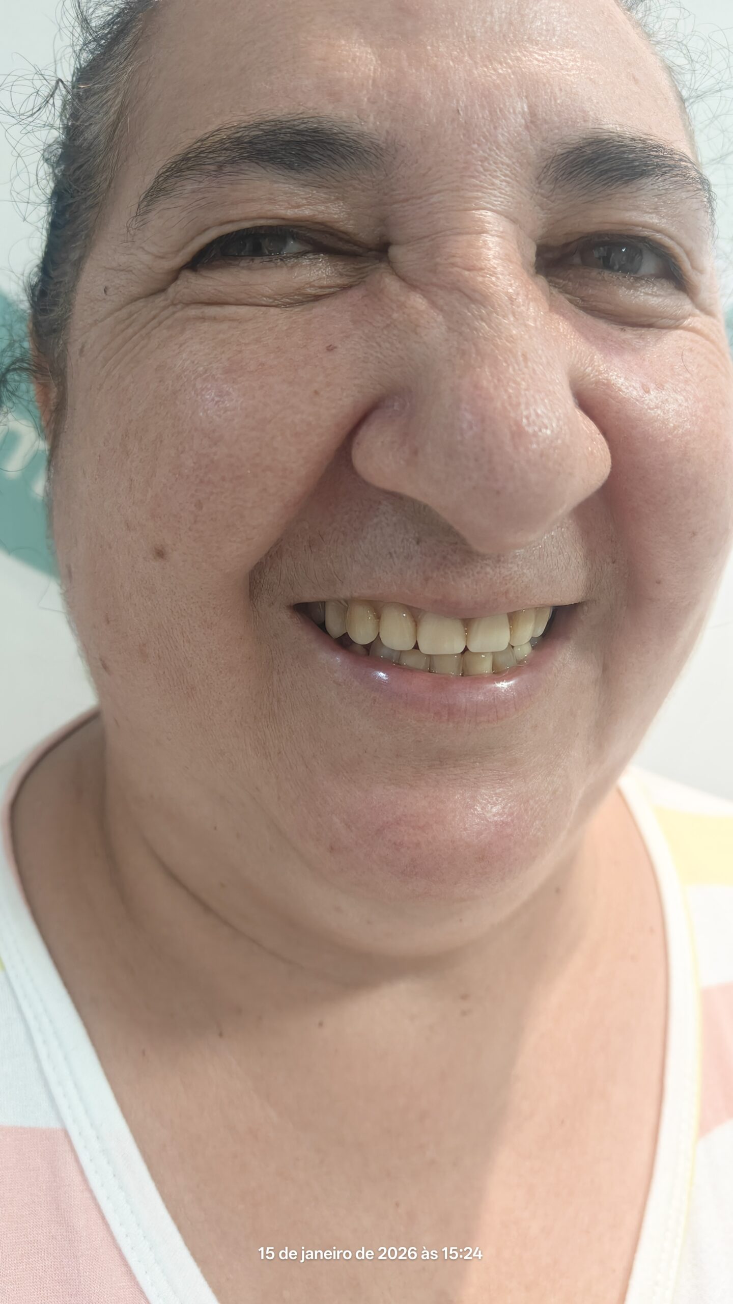 Sorriso Antes do Tratamento